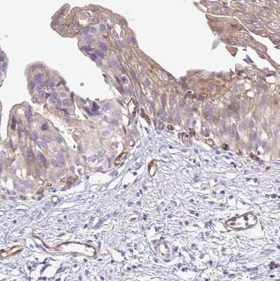 Immunohistochemistry-Paraffin: EHD4 Antibody [NBP2-33665] - Staining of human urinary bladder shows moderate membranous and cytoplasmic positivity in urothelial cells, as well as in endothelial cells.