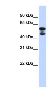 Western Blot: EHD4 Antibody [NBP1-54872] - Human Lung lysate, concentration 0.2-1 ug/ml.