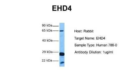 Western Blot: EHD4 Antibody [NBP1-54873] - Sample Tissue: Human 786-0 Antibody Dilution: 1.0 ug/ml