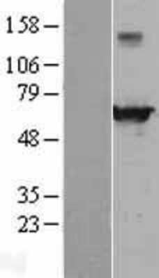 Western Blot: EHD4 Overexpression Lysate (Adult Normal) [NBL1-10160] Left-Empty vector transfected control cell lysate (HEK293 cell lysate); Right -Over-expression Lysate for EHD4.
