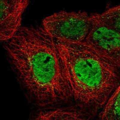 Immunocytochemistry/Immunofluorescence: EHF Antibody [NBP2-56705] - Staining of human cell line A-431 shows localization to nucleoplasm & the Golgi apparatus. Antibody staining is shown in green.