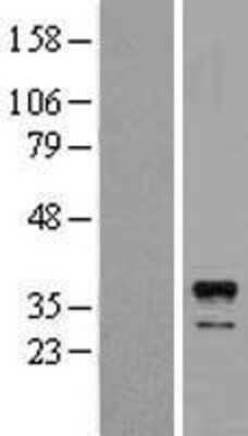 Western Blot: EHF Overexpression Lysate (Adult Normal) [NBL1-10161] Left-Empty vector transfected control cell lysate (HEK293 cell lysate); Right -Over-expression Lysate for EHF.