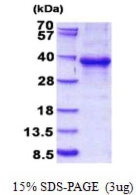 SDS-Page: EHF Protein [NBP2-23029]