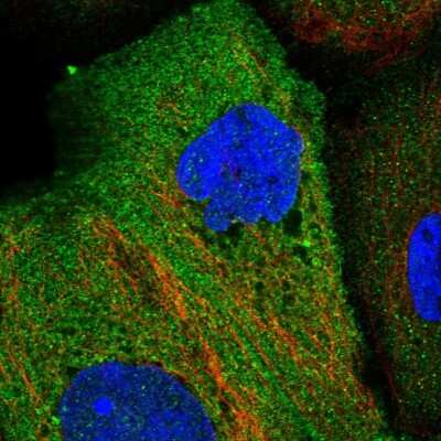 Immunocytochemistry/Immunofluorescence: EHM2 Antibody [NBP1-83988] - Immunofluorescent staining of human cell line A-431 shows localization to plasma membrane & cytosol.