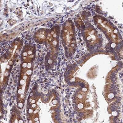 Immunohistochemistry-Paraffin: EHM2 Antibody [NBP1-83988] - Staining of human duodenum shows moderate cytoplasmic positivity in glandular cells.