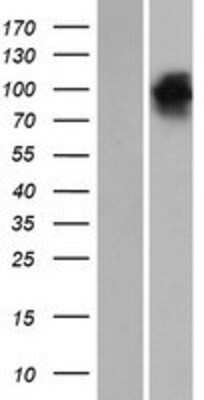 Western Blot: EHM2 Overexpression Lysate (Adult Normal) [NBP2-06716] Left-Empty vector transfected control cell lysate (HEK293 cell lysate); Right -Over-expression Lysate for EHM2.