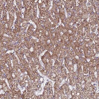 Immunohistochemistry-Paraffin EI24 Antibody