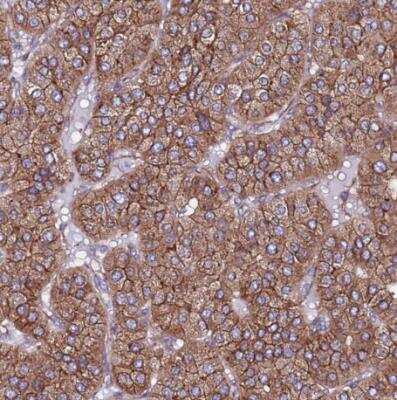 Immunohistochemistry-Paraffin EI24 Antibody