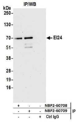 Immunoprecipitation: EI24 Antibody [NBP2-60709] - Detection of immunoprecipitates. Samples: Whole cell lysate (0.5 or 1.0 mg per IP reaction; 20% of IP loaded) from Jurkat cells prepared using NETN lysis buffer. Antibodies: Affinity purified rabbit anti-EI24 antibody NBP2-60709 used for IP at 8 ul per reaction. EI24 was also immunoprecipitated by rabbit anti-EI24 antibody NBP2-60708. For blotting immunoprecipitated EI24, NBP2-60709 was used at 1:1000. Detection: Chemiluminescence with an exposure time of 30 seconds.