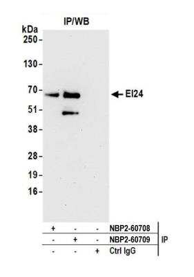 Immunoprecipitation: EI24 Antibody [NBP2-60709] - Detection of human EI24 by western blot of immunoprecipitates. Samples: Whole cell lysate (0.5 or 1.0 mg per IP reaction; 20% of IP loaded) from Jurkat cells prepared using NETN lysis buffer. Antibodies: Affinity purified rabbit anti-EI24 antibody NBP2-60709 used for IP at 8 ul per reaction. EI24 was also immunoprecipitated by rabbit anti-EI24 antibody NBP2-60708. For blotting immunoprecipitated EI24, NBP2-60709 was used at 1:1000. Detection: Chemiluminescence with an exposure time of 30 seconds.