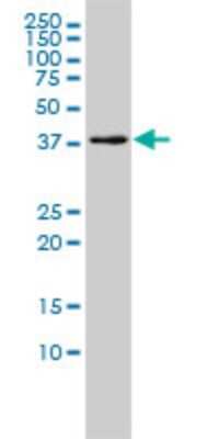 Western Blot: EI2BL Antibody (2D11-1G4) [H00084245-M01] - MGC3207 monoclonal antibody (M01), clone 2D11-1G4 Analysis of MGC3207 expression in HL-60.