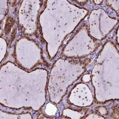 Immunohistochemistry EI2BL Antibody - BSA Free