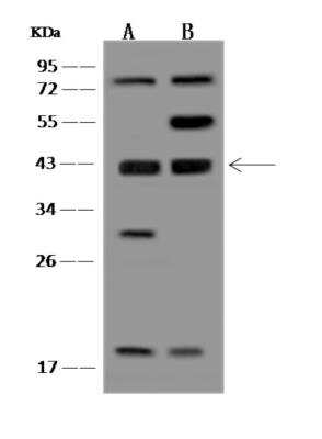 Western Blot: EI2BL Antibody [NBP3-06310] - EI2BL antibody rabbit polyclonal antibody at 1:500 dilutionLane A: RT-4 Whole Cell LysateLane B: U-251MG Whole Cell LysateLysates/proteins at 30 ug per lane.SecondaryGoat Anti-Rabbit IgG (H+L)HRP  at 110000 dilution.Developed using the ECL technique.Performed under reducing conditions.Predicted band size:39 kDa(We are unsure as to the identity of these extra bands.)