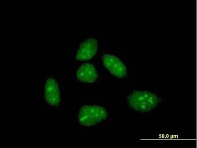 Immunocytochemistry/Immunofluorescence: EID1 Antibody [H00023741-B01P] - Analysis of purified antibody to CRI1 on HeLa cell. (antibody concentration 10 ug/ml)