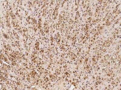 Immunohistochemistry: EID1 Antibody [NBP2-97540] - Immunochemical staining of human EID1 in human adrenal gland with rabbit polyclonal antibody at 1:100 dilution, formalin-fixed paraffin embedded sections.