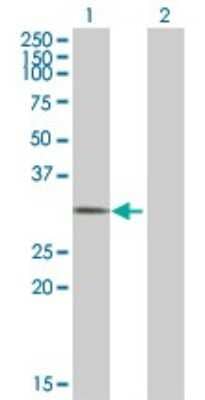 Western Blot: EID1 Antibody [H00023741-B01P] - Analysis of EID1 expression in transfected 293T cell line by EID1 polyclonal antibody.  Lane 1: CRI1 transfected lysate(20.57 KDa). Lane 2: Non-transfected lysate.