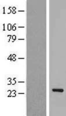 Western Blot: EID1 Overexpression Lysate (Adult Normal) [NBP2-07353] Left-Empty vector transfected control cell lysate (HEK293 cell lysate); Right -Over-expression Lysate for EID1.