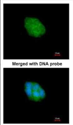 Immunocytochemistry/Immunofluorescence: EIF2AK1 Antibody [NBP2-16291] - Immunofluorescence analysis of paraformaldehyde-fixed A431, using antibody at 1:200 dilution.