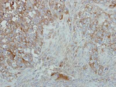Immunohistochemistry-Paraffin: EIF2AK1 Antibody [NBP2-16291] - Immunohistochemical analysis of paraffin-embedded H661 xenograft, using antibody at 1:500 dilution.