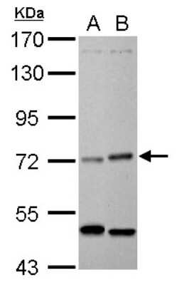 Western Blot: EIF2AK1 Antibody [NBP2-16291] - EIF2AK1 antibody detects EIF2AK1 protein by Western blot analysis. A. 30 ug HeLa whole cell lysate/extract B. 30 ug A375 whole cell lysate/extract7. 5 % SDS-PAGEEIF2AK1 antibody dilution: 1:1000.
