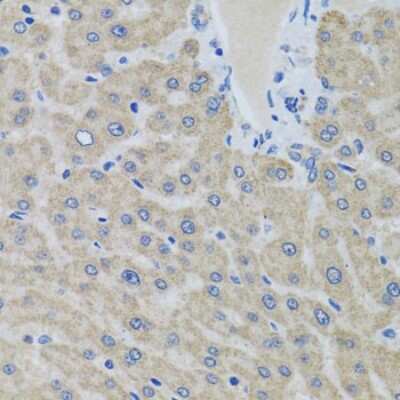 Immunohistochemistry-Paraffin: EIF2G Antibody [NBP3-03513] - Paraffin-embedded human liver using EIF2G antibody at dilution of 1:100 (40x lens).