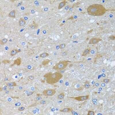 Immunohistochemistry-Paraffin: EIF2G Antibody [NBP3-03513] - Paraffin-embedded rat brain using EIF2G antibody at dilution of 1:100 (40x lens).