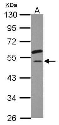 Western Blot: EIF2G Antibody [NBP2-16294] - Sample (30 ug of whole cell lysate) A: HepG2 10% SDS PAGE gel, diluted at 1:1000.