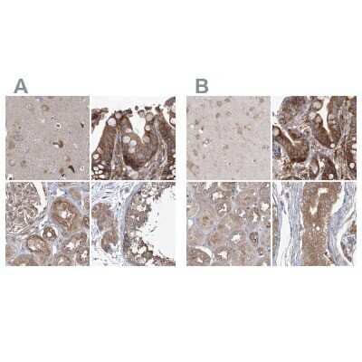 <b>Independent Antibodies Validation. </b>Immunohistochemistry-Paraffin: EIF3A Antibody [NBP1-84875] - Staining of human cerebral cortex, colon, kidney and testis using Anti-EIF3A antibody NBP1-84875 (A) shows similar protein distribution across tissues to independent antibody NBP1-84876 (B).