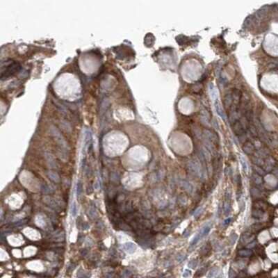 Immunohistochemistry-Paraffin: EIF3A Antibody [NBP1-84875] - Staining of human colon.