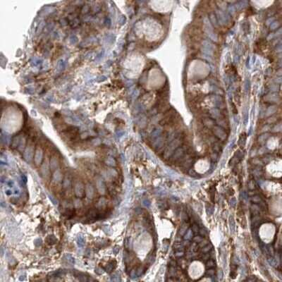 Immunohistochemistry-Paraffin: EIF3A Antibody [NBP1-84876] - Staining of human colon.