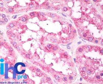 Immunohistochemistry-Paraffin: EIF3A Antibody [NBP2-24570] - Formalin-fixed, paraffin-embedded human brain tissue stained with eIF3A antibody at 10 ug/ml. Staining of formalin-fixed tissues is enhanced by boiling tissue sections in 10 mM sodium citrate buffer, pH 6.0 for 10-20 min followed by cooling at RT for 20 min.