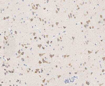 Immunohistochemistry-Paraffin: EIF3A Antibody [NBP3-12794] - Staining of human EIF3A in human brain with rabbit polyclonal antibody at 1:300 dilution.