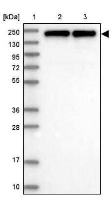 Western Blot: EIF3A Antibody [NBP1-84876] - Lane 1: Marker  [kDa] 250, 130, 95, 72, 55, 36, 28, 17, 10.  Lane 2: Human cell line RT-4.  Lane 3: Human cell line U-251MG sp