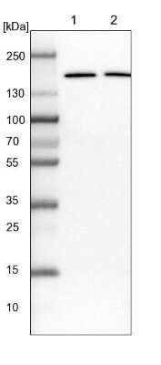 <b>Independent Antibodies Validation. </b>Western Blot: EIF3A Antibody [NBP1-84876] - Lane 1: NIH-3T3 cell lysate (Mouse embryonic fibroblast cells). Lane 2: NBT-II cell lysate (Rat Wistar bladder tumor cells).