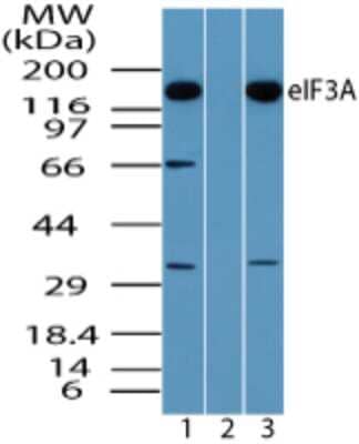 Western Blot: EIF3A Antibody [NBP2-24570] - analysis of eIF3A in Daudi lysate in the 1) absence and 2) presence of immunizing peptide and 3) NIH 3T3 lysate using eIF3A antibody at 0.5 ug/ml, 0.5 ug/ml and 0.25 ug/ml respectively.