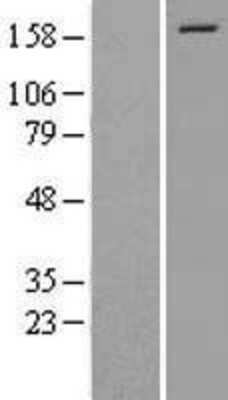 Western Blot: EIF3A Overexpression Lysate (Adult Normal) [NBL1-10188] Left-Empty vector transfected control cell lysate (HEK293 cell lysate); Right -Over-expression Lysate for EIF3A.