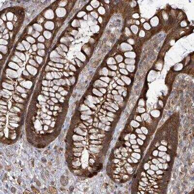 Immunohistochemistry-Paraffin: EIF3C Antibody [NBP2-46784] - Staining of human rectum shows strong cytoplasmic positivity in glandular cells.