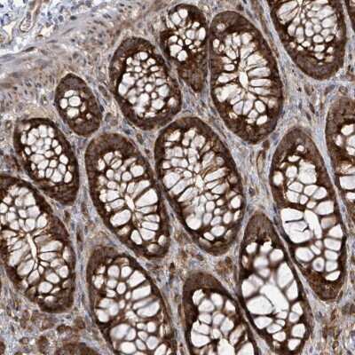 Immunohistochemistry-Paraffin: EIF3C Antibody [NBP2-46741] - Staining of human colon shows strong cytoplasmic positivity in glandular cells.