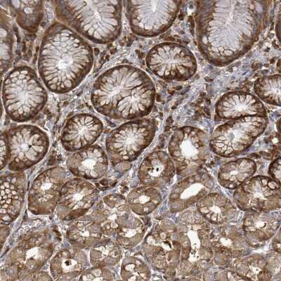 Immunohistochemistry-Paraffin: EIF3C Antibody [NBP2-46772] - Staining of human stomach, lower shows strong cytoplasmic positivity in glandular cells.