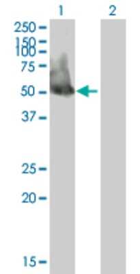 Western Blot: EIF3F Antibody [H00008665-B01P] - Analysis of EIF3F expression in transfected 293T cell line by EIF3F polyclonal antibody.  Lane 1: EIF3S5 transfected lysate(39.27 KDa). Lane 2: Non-transfected lysate.