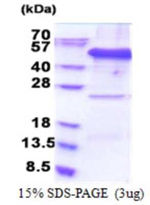 SDS-PAGE Recombinant Human EIF3F His Protein
