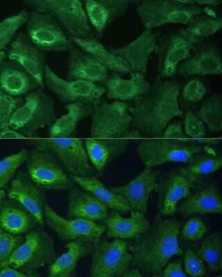 Immunocytochemistry/Immunofluorescence: EIF3G Antibody [NBP3-04672] - Analysis of U-2 OS cells using EIF3G antibody at dilution of 1:100 (40x lens). Blue: DAPI for nuclear staining.