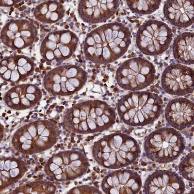 Immunohistochemistry-Paraffin: EIF3G Antibody [NBP1-84872] - Staining of human colon shows strong cytoplasmic positivity in glandular cells.