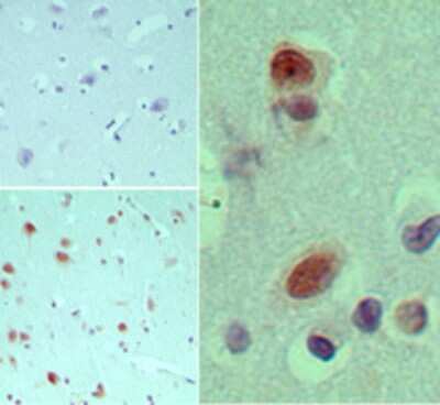 Immunohistochemistry-Paraffin: EIF3G Antibody [NBP2-24685] - analysis of eIF3G in formalin-fixed, paraffin-embedded human brain tissue using an isotype control (top left) and this antibody (bottom left, right) at 5 ug/ml.