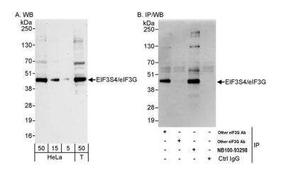 Western Blot: EIF3G Antibody [NB100-93298] - Detection of human eIF3G/EIF3S4 by western blot and immunoprecipitation. Samples: Whole cell lysate from HeLa (5, 15 and 50 ug for WB; 1 mg for IP, 20% of IP loaded) and HEK293T (T; 50 ug) cells. Antibodies: Affinity purified rabbit anti-eIF3G/EIF3S4 antibody NB100-93298 used for WB at 0.04 ug/ml (A) and 1 ug/ml (B) and used for IP at 3 ug/mg lysate. eIF3G/EIF3S4 was also immunoprecipitated by two other rabbit anti-eIF3G/EIF3S4 antibodies, which recognize upstream epitopes. Detection: Chemiluminescence with exposure times of 3 minutes (A) and 3 seconds (B).