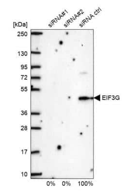 Western Blot: EIF3G Antibody [NBP1-84872] - Analysis in U2OS cells transfected with control siRNA, target specific siRNA probe #1 and #2. Remaining relative intensity is presented.