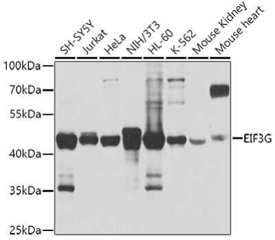 Western Blot: EIF3G Antibody [NBP3-04672] - Analysis of extracts of various cell lines, using EIF3G antibody at 1:1000 dilution. Secondary antibody: HRP Goat Anti-Rabbit IgG (H+L) at 1:10000 dilution. Lysates/proteins: 25ug per lane. Blocking buffer: 3% nonfat dry milk in TBST. Detection:ECL Basic Kit