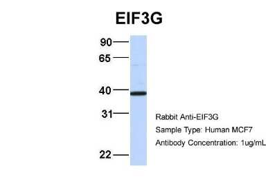 Western Blot: EIF3G Antibody [NBP3-10537] - Host: Rabbit. Target Name: EIF3G. Sample Type: MCF7. Antibody Dilution: 1.0ug/ml EIF3G is supported by BioGPS gene expression data to be expressed in MCF7