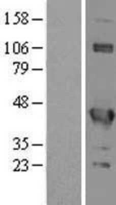 Western Blot: EIF3G Overexpression Lysate (Adult Normal) [NBL1-10195] Left-Empty vector transfected control cell lysate (HEK293 cell lysate); Right -Over-expression Lysate for EIF3G.