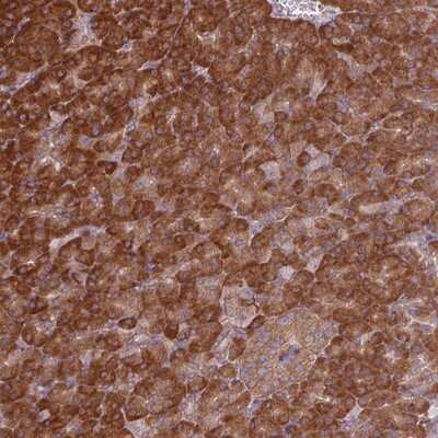 Immunohistochemistry-Paraffin: EIF3J Antibody [NBP2-13953] - Staining of human pancreas shows strong cytoplasmic positivity in exocrine glandular cells.